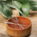 Why Consider Acupuncture for Weight Loss Support?